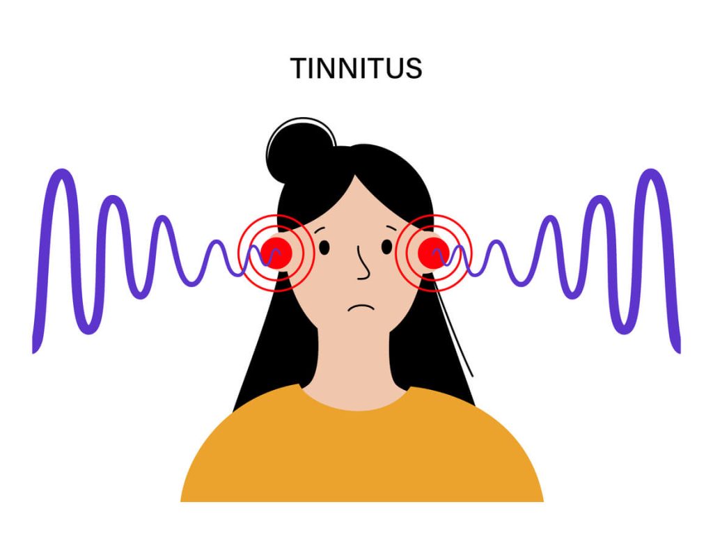 tinnitus acupuncture ivanhoe